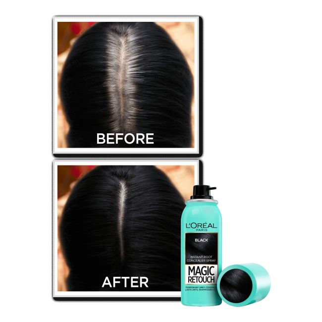 L'OREAL MAGIC RETOUCH ataugusių plaukų šaknų purškiklis, 75 ml